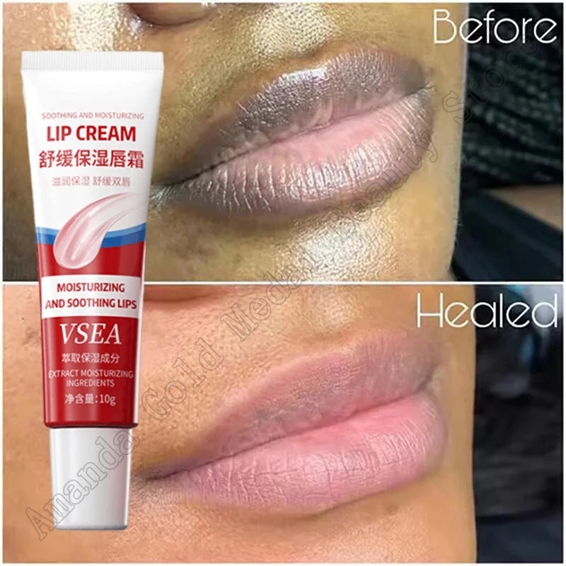 Dark Lip Corrector Balm – Fast Lightening, Pink Lip Moisturizer & Exfoliator
