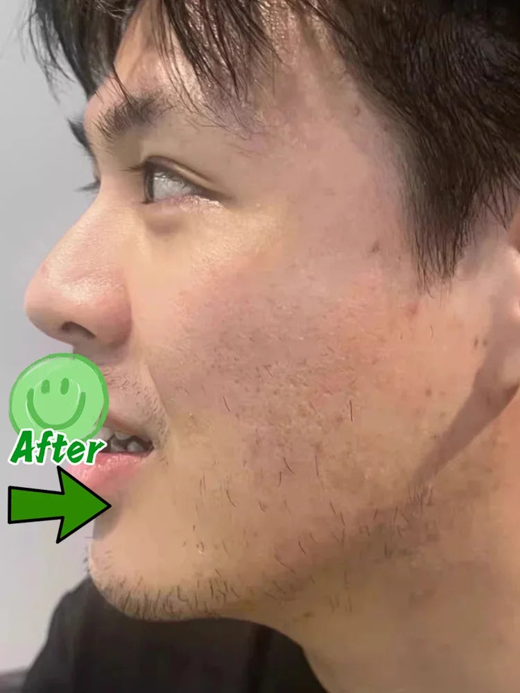 Pore Minimizing & Acne Scar Repair Cream – Smooth Skin for Men & Women