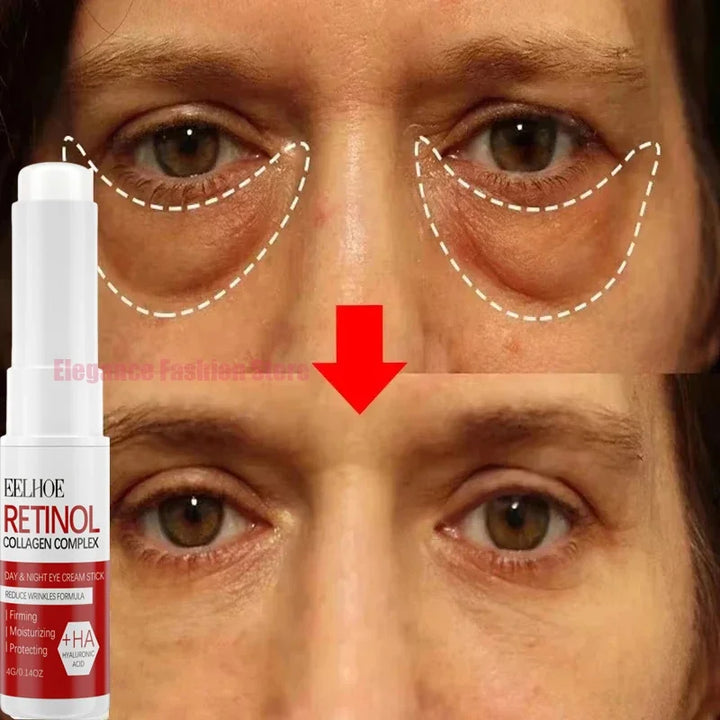 Instant Eye Cream – Reduces Eye Bags, Dark Circles & Puffiness, Lifting & Brightening Formula