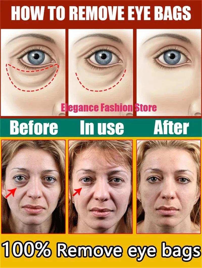 Instant Eye Cream – Reduces Eye Bags, Dark Circles & Puffiness, Lifting & Brightening Formula