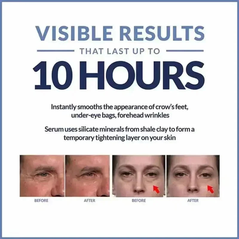 Instant Eye Cream – Anti-Aging, Dark Circles, Puffiness & Under-Eye Lifting Treatment