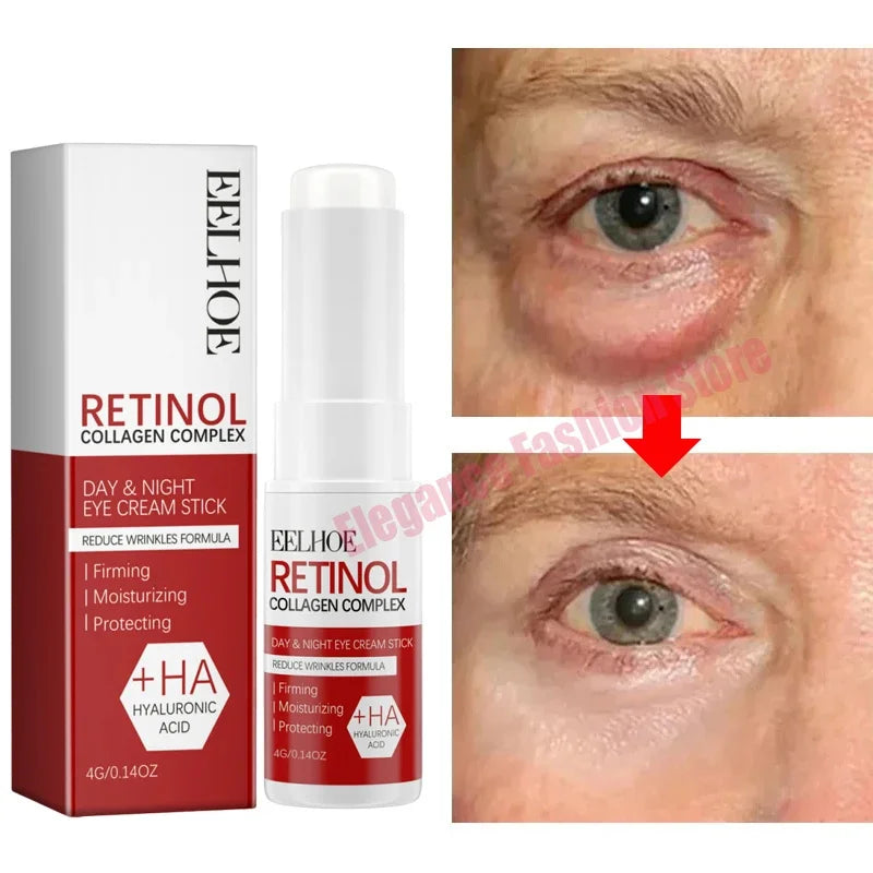 Instant Eye Cream – Reduces Eye Bags, Dark Circles & Puffiness, Lifting & Brightening Formula