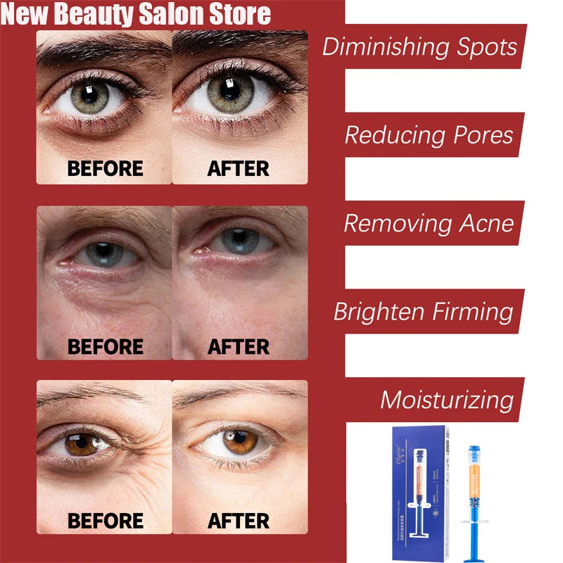 Retinol Anti-Aging Face Cream – Wrinkle Remover, Firming & Moisturizing Skincare