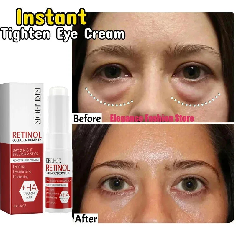 Instant Eye Cream – Reduces Eye Bags, Dark Circles & Puffiness, Lifting & Brightening Formula