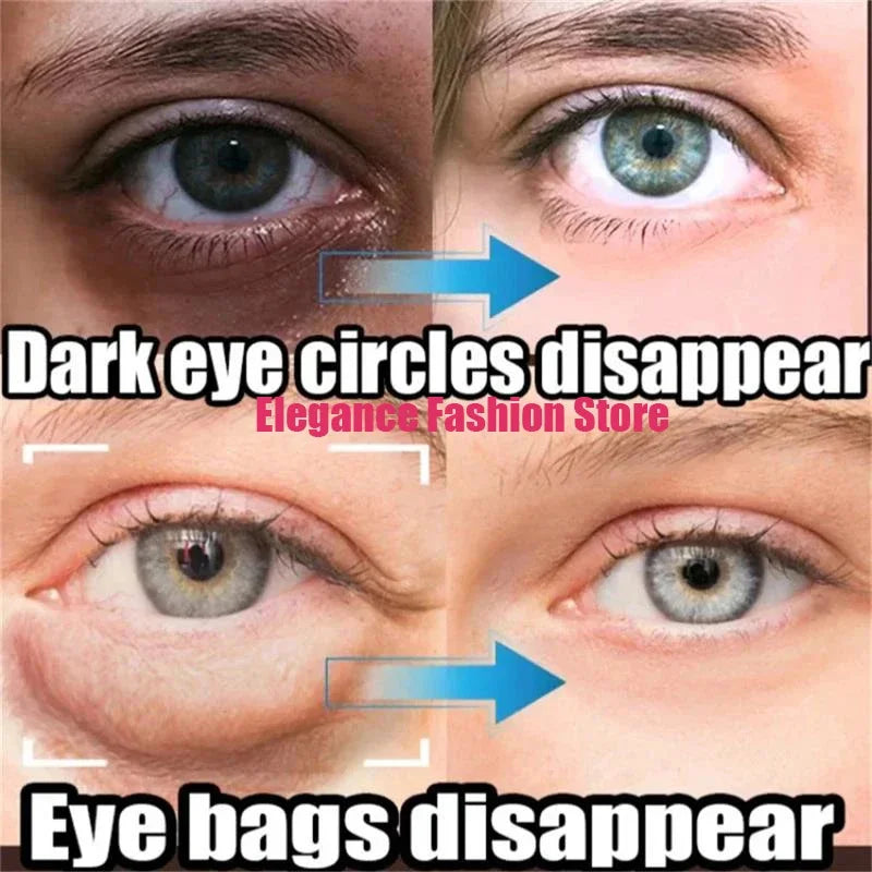 Instant Eye Cream – Reduces Eye Bags, Dark Circles & Puffiness, Lifting & Brightening Formula