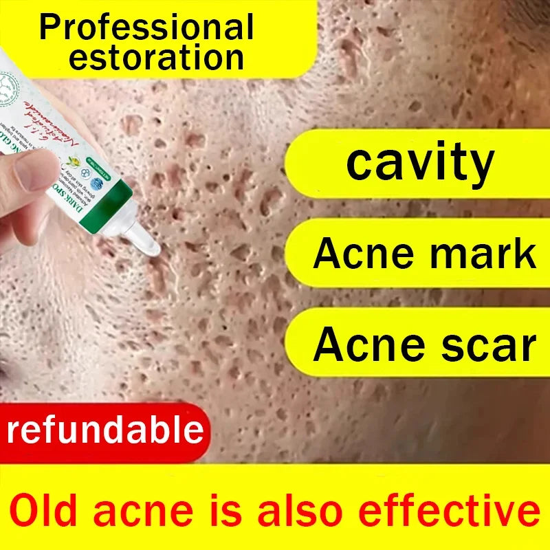 Pore Minimizing & Acne Scar Repair Cream – Smooth Skin for Men & Women