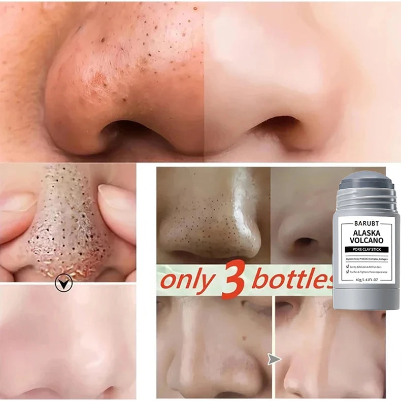 Mugwort Blackhead Removal Stick – Pore Cleansing Solid Mask for Smooth, Clear Skin