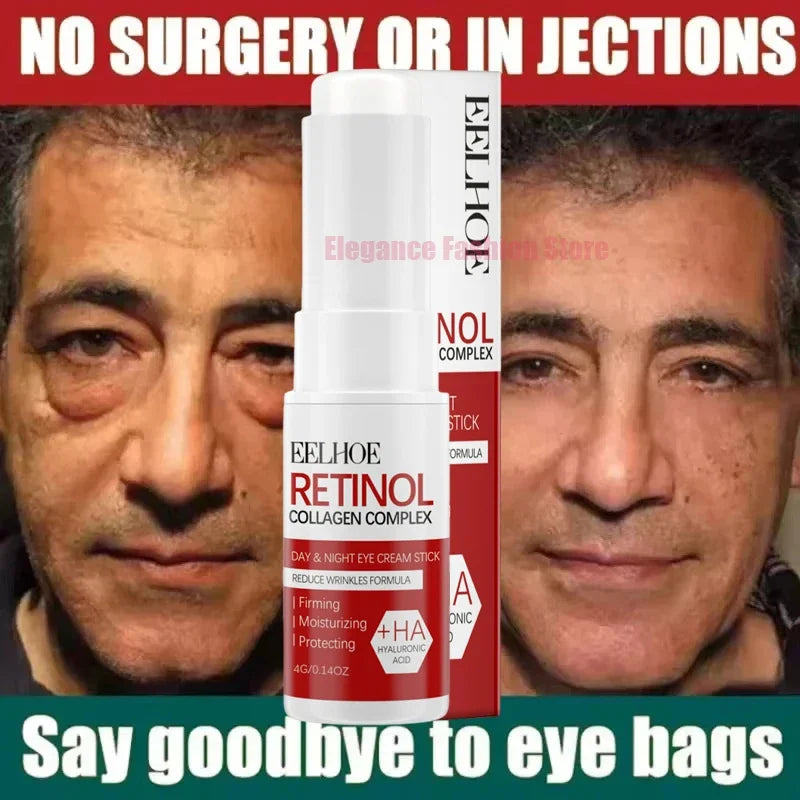 Instant Eye Cream – Reduces Eye Bags, Dark Circles & Puffiness, Lifting & Brightening Formula