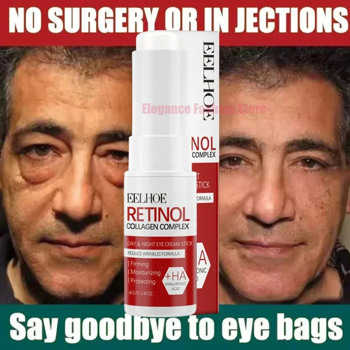 Instant Eye Cream – Reduces Eye Bags, Dark Circles & Puffiness, Lifting & Brightening Formula