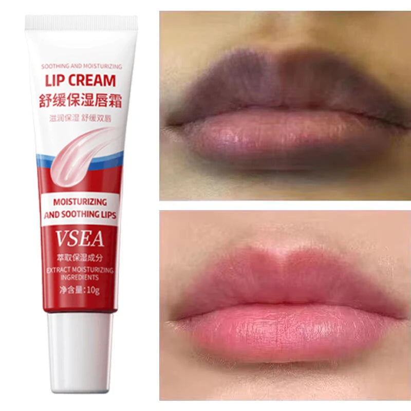 Dark Lip Corrector Balm – Fast Lightening, Pink Lip Moisturizer & Exfoliator