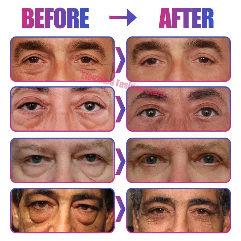 Instant Eye Cream – Reduces Eye Bags, Dark Circles & Puffiness, Lifting & Brightening Formula