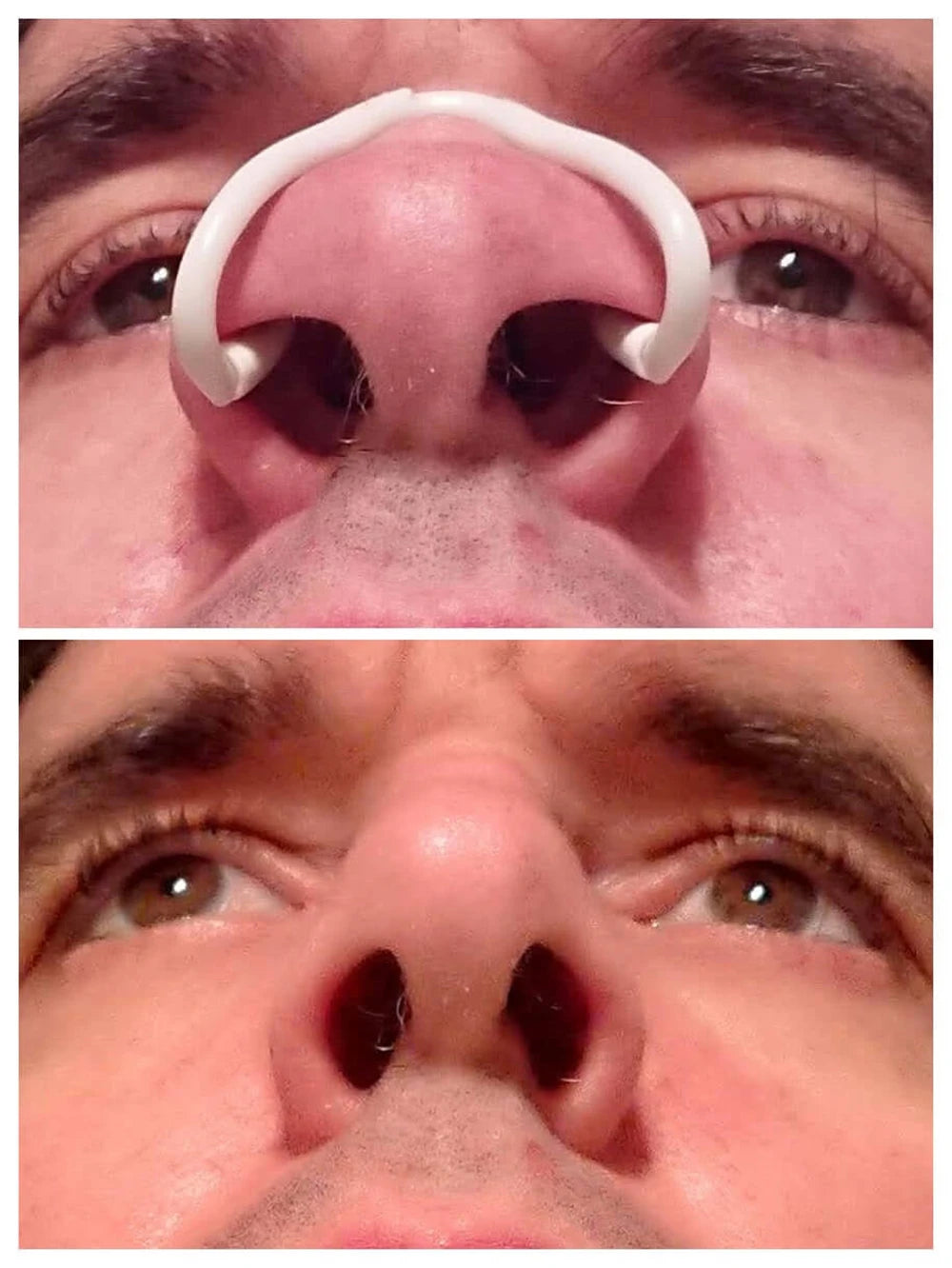 Silicone Nasal Dilator – Anti-Snoring Nose Clip for Easier Breathing & Better Sleep