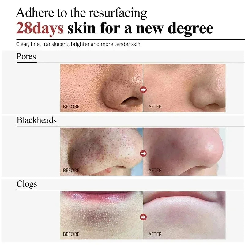 Pore Minimizing & Acne Scar Repair Cream – Smooth Skin for Men & Women