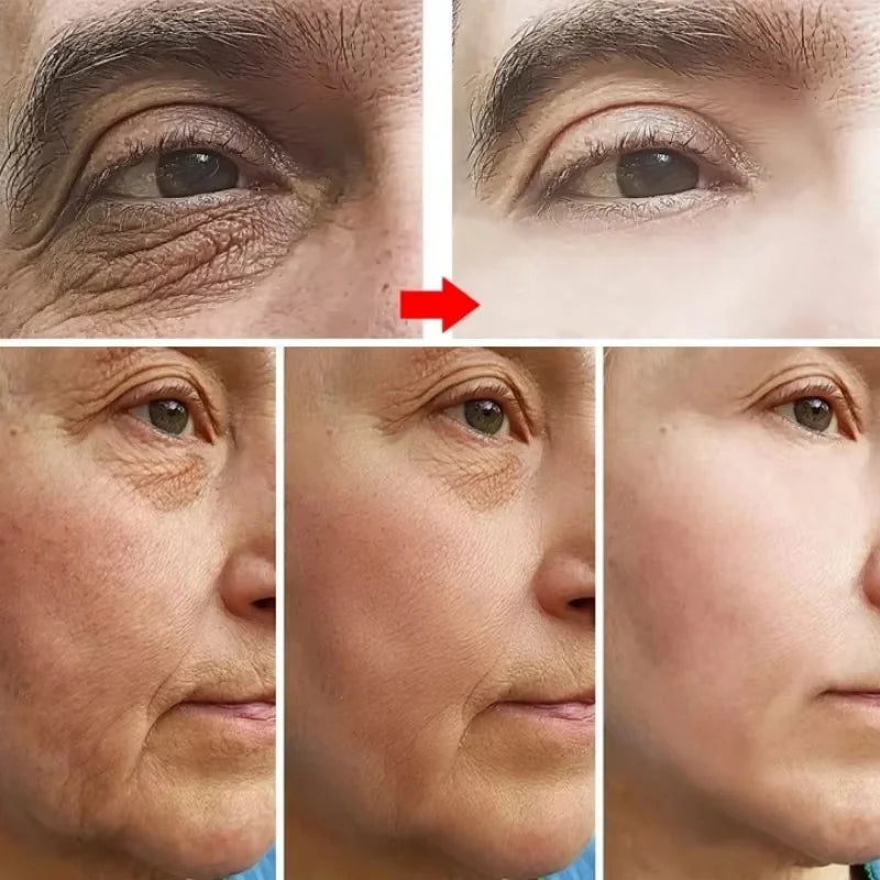 Retinol Anti-Aging Face Cream – Wrinkle Remover, Firming & Moisturizing Skincare