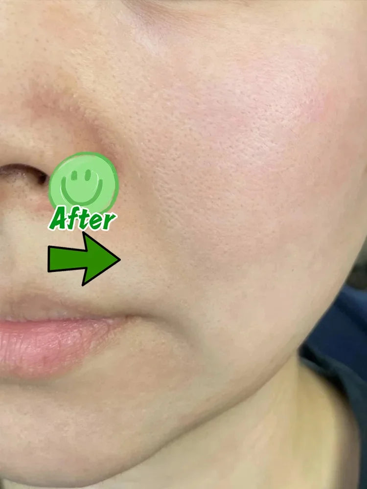 Pore Minimizing & Acne Scar Repair Cream – Smooth Skin for Men & Women