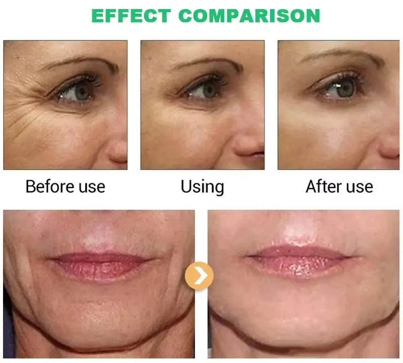 Retinol Anti-Aging Face Cream – Wrinkle Remover, Firming & Moisturizing Skincare