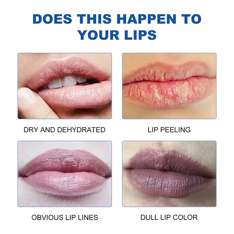 Dark Lip Corrector Balm – Fast Lightening, Pink Lip Moisturizer & Exfoliator