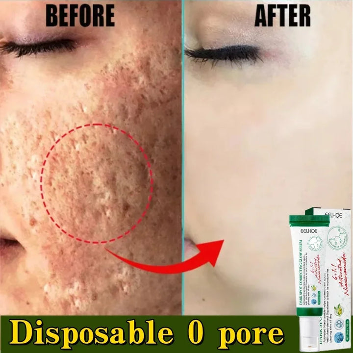 Pore Minimizing & Acne Scar Repair Cream – Smooth Skin for Men & Women